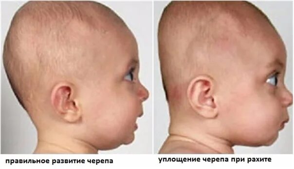 В ее черепной коробке нету ни