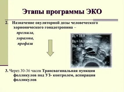 Пункция фолликулов отзывы форум
