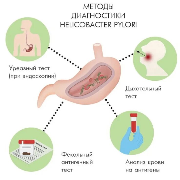 Сдача анализов на хеликобактер пилори. Методы обследования хеликобактер пилори. Метод выявления хеликобактер. Методы выявления бактерии хеликобактер. Методы диагностики h pylori у детей.