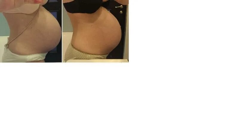 опустился живот в 30 недель. как выглядит опущенный живот. опустившийся живот перед родами. животик в 34 недели беременности. 32 недели опустился живот.