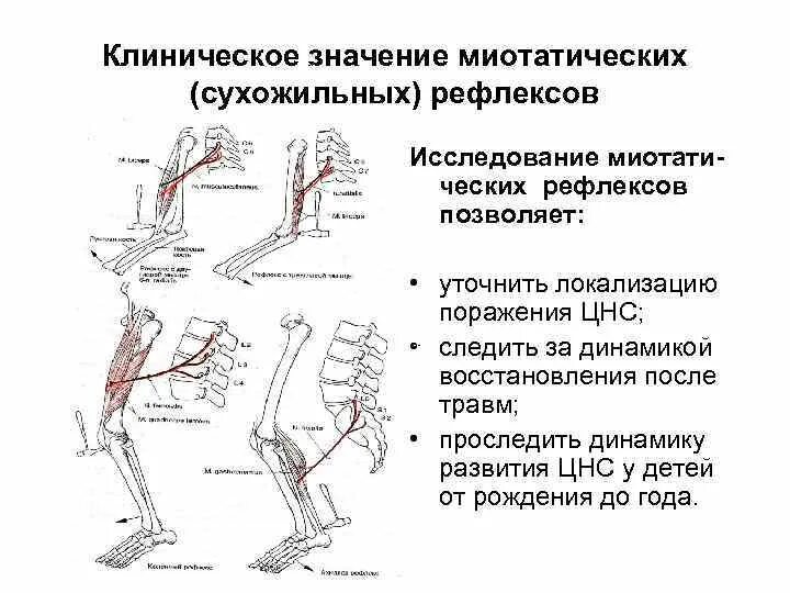 Рефлексы верхних конечностей. Клиническое значение рефлексов. Значение сухожильных рефлексов. Клиническое значение сухожильных рефлексов. Значение сухожильных рефлексов физиология.