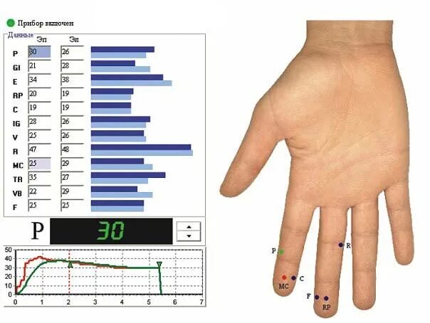 Электропунктурное тестирование по методу кристалл. Диагностика кристалл стрельникова. Тестирование кристалл. Кристалл тестирование. Сертификат книжный доктор.