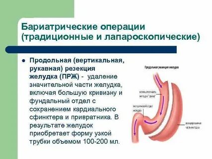 Какие операции делают на желудке