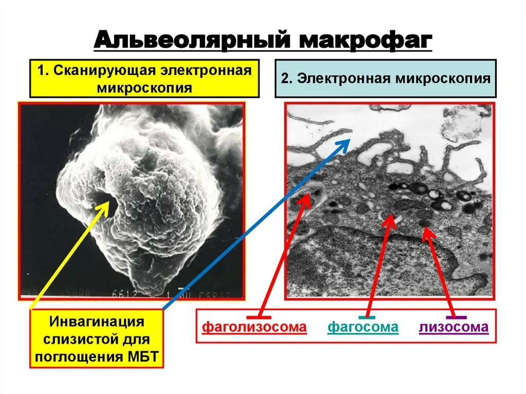 Альвеолярные макрофаги. Альвеолярные фагоциты. Легочные макрофаги. Альвеолярный Макрофаг строение.