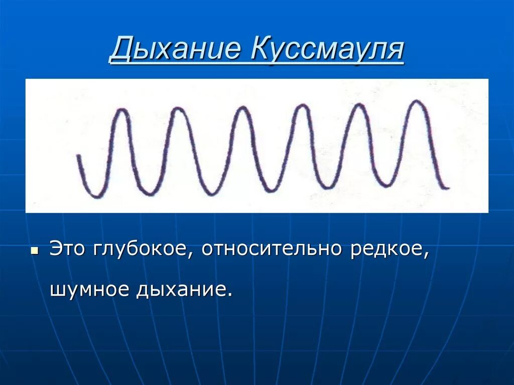 1 редкое дыхание. Патологические типы дыхания Куссмауля. Дыхание Куссмауля Биота. Куссмауля Чейна Стокса Биота. Типы дыхания Куссмауля Чейна.