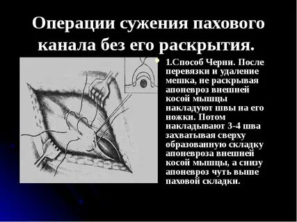 Герниология что это