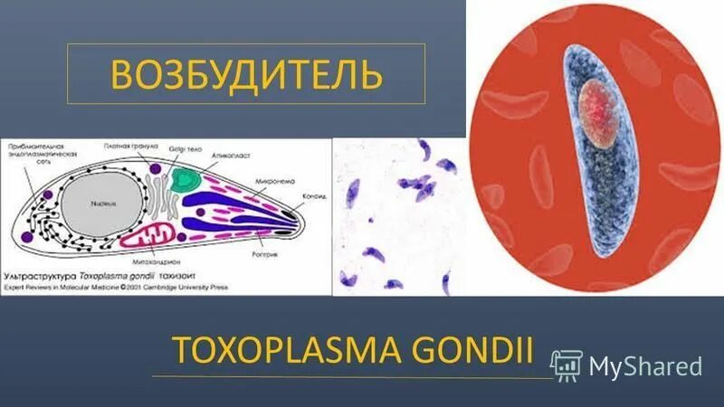Toxoplasma gondii пути заражения. токсоплазма микроскопия. токсоплазмоз toxoplasma gondii. жизненный цикл токсоплазмы гонди. токсоплазмоз toxoplasma gondii.