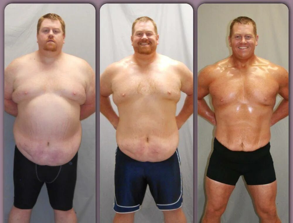 Трансформация тела. Живот до и после похудения мужчины. Трансформация похудение мужчин.