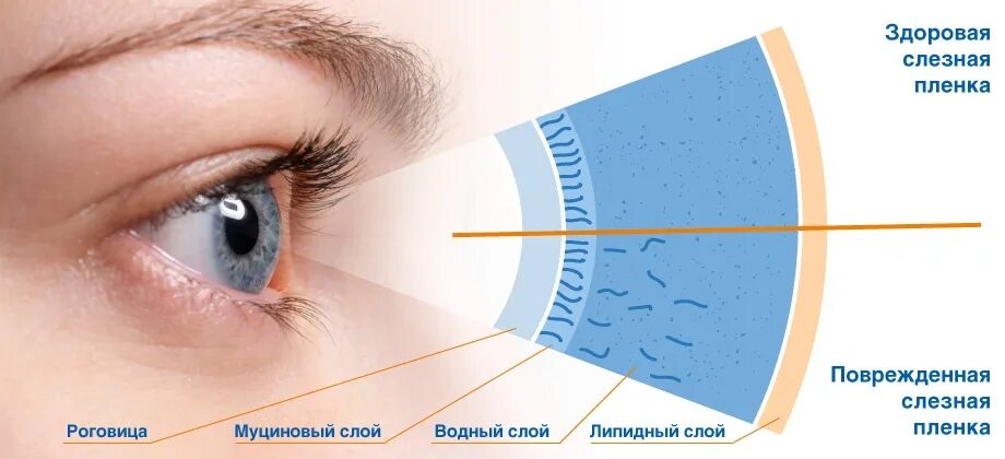 Причины симптома сухого глаза. Строение слезной пленки. Слезная пленка сухой глаз. Сидромсухового глаза. Водный слой слезной пленки.