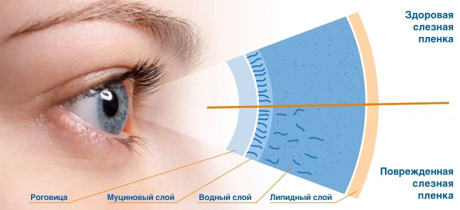 Строение слезной пленки. Слезная пленка сухой глаз. Сидромсухового глаза. Водный слой слезной пленки.