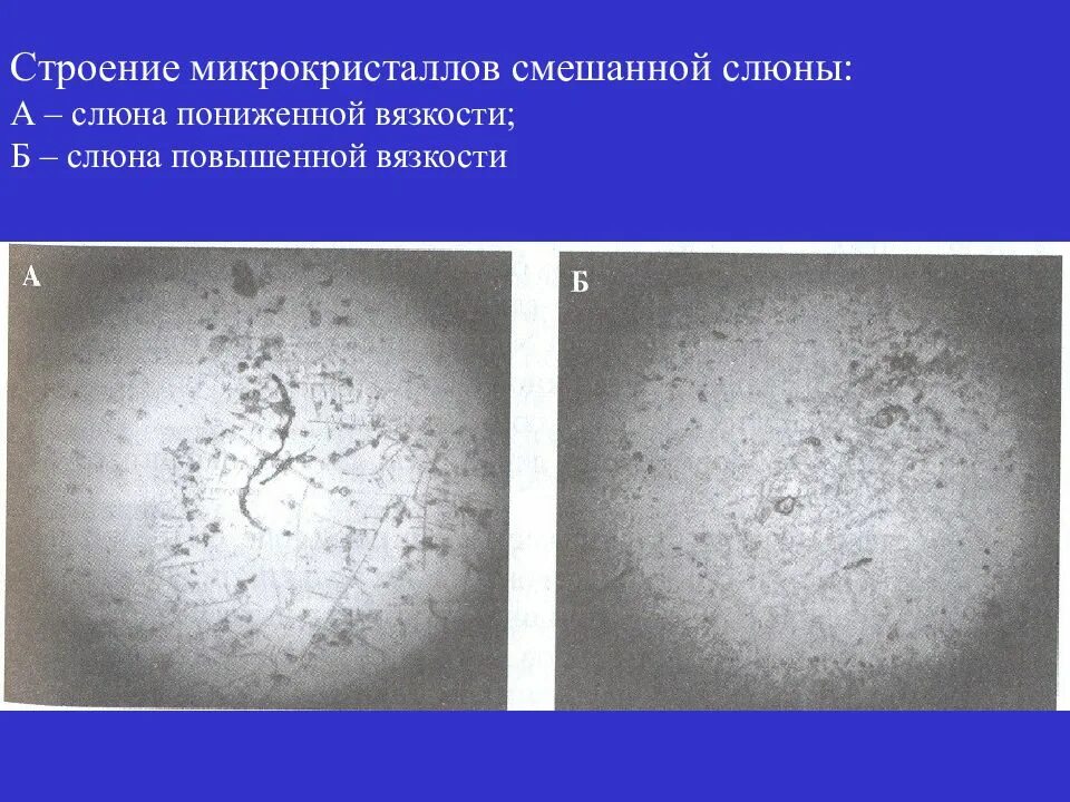 Почему пенится слюна. Структура слюны. Структура муцина слюны. Структура слюны биохимия. Повышенная вязкость слюны.