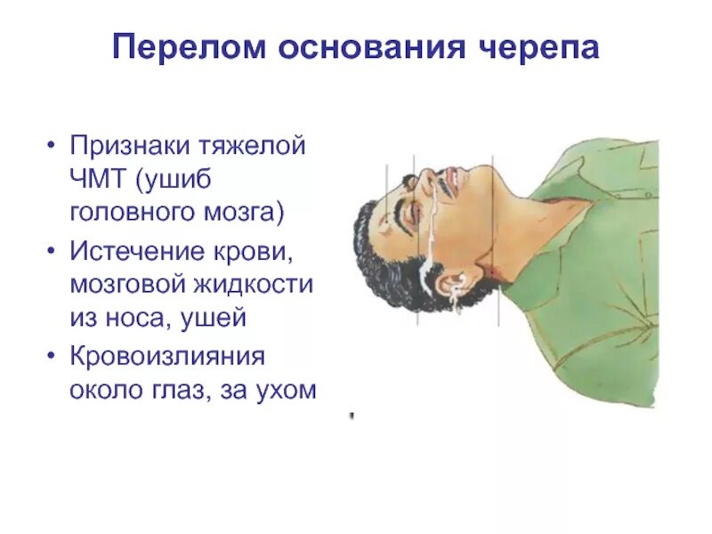 Затылком об лед. Симптом очков при переломе основания черепа. При переломе основания черепа. Симптомы при переломе черепа. Симптомы при переломе костей черепа.