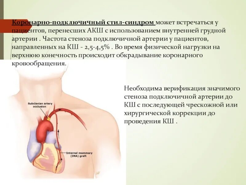 Стеноз подключичной