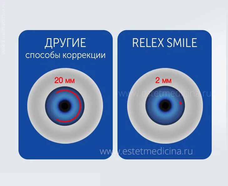 Relex smile clinicaspectr ru