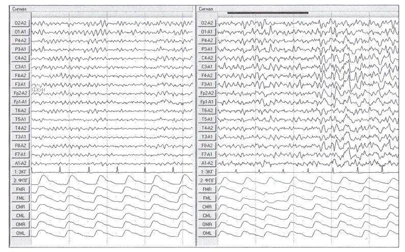 Ээг лаб. Ээг лаборатория. Векторные иконки электроэнцефалография. Ээг для лабы. Электроэнцефалограмма значок.