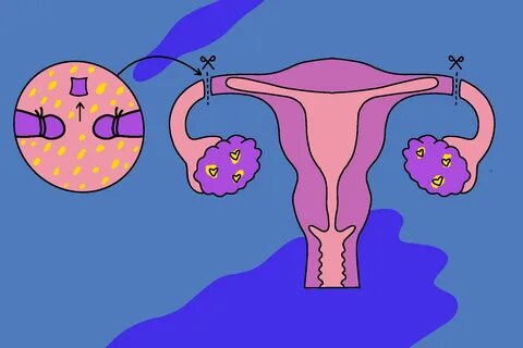 Правда и вымысел о зачатии от секса в попу