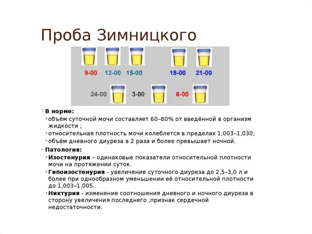 Проба зимницкого тест