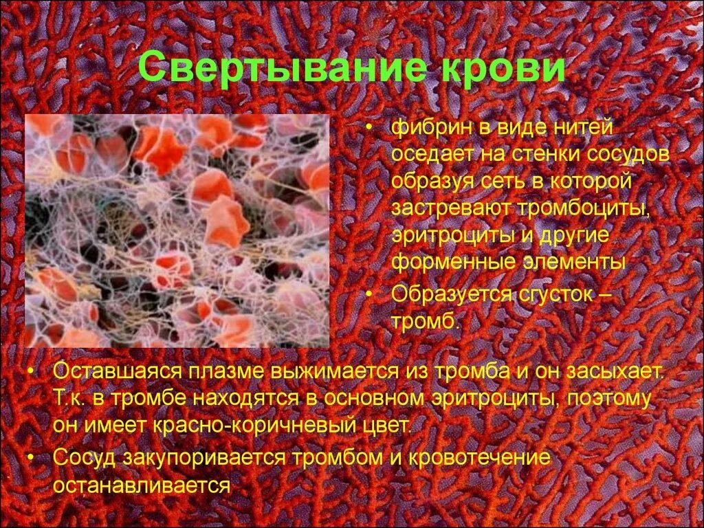 Как изменится количество фибрина после пореза. Нити фибрина под микроскопом. Фибриновая сеть.