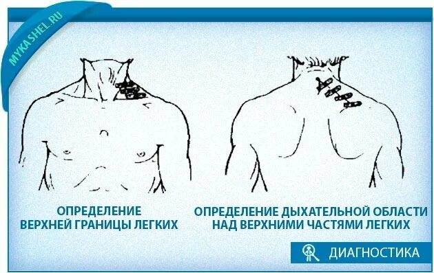 Перкуссия верхней границы легкого. Прекусси яверхней границы легкого. Определение верхних границ легких. Определение верхней границы лёгких. Границы легких определяются