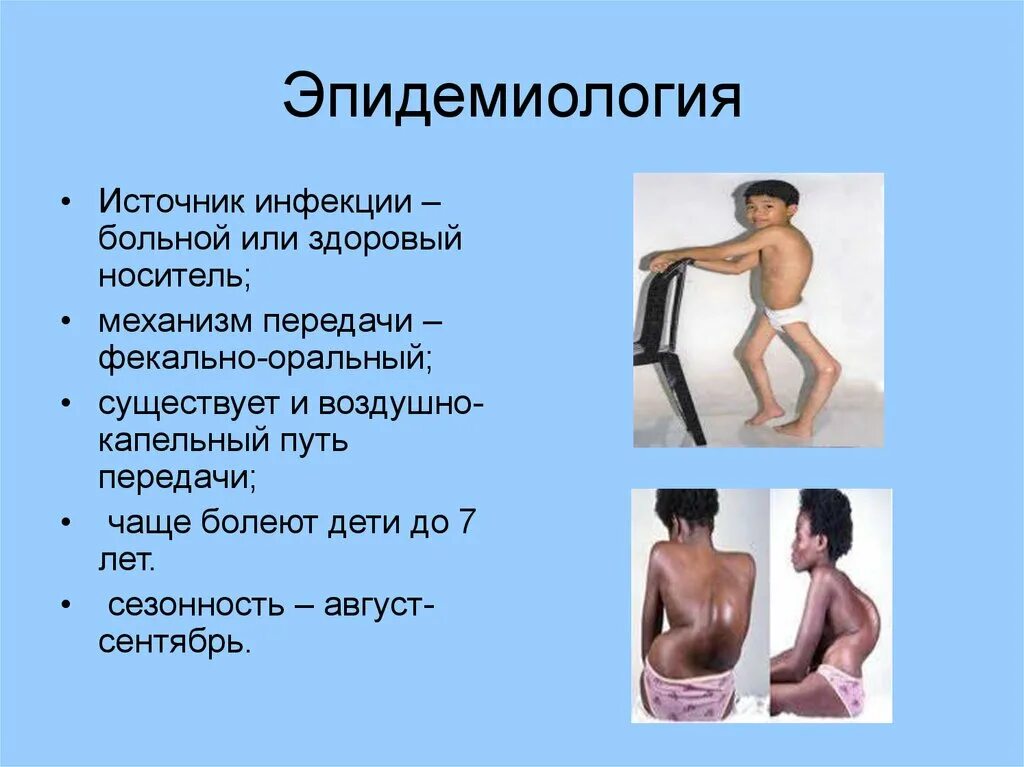 Клинические симптомы полиомиелита. Спинальный полиомиелит у детей. Полиомиелит инфекционное заболевание. Полиомиелит пути передачи возбудителя инфекции. Полиомиелит пути передачи инфекции.