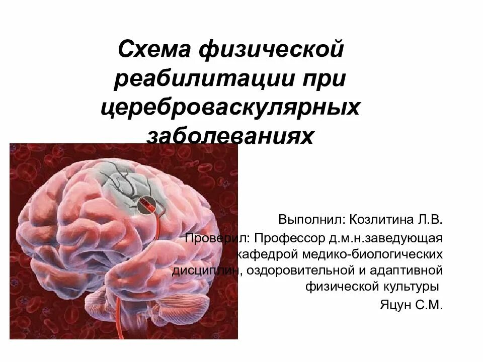 Цереброваскулярные заболевания. Цереброваскулярная недостаточность. Классификация цереброваскулярных болезней. Цереброваскулярный синдром.