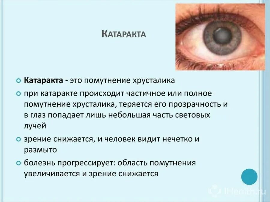 Катаракта причины и профилактика. Катаракта – помутнение хрусталика глаза.. Катаракта глаза симптомы причины.