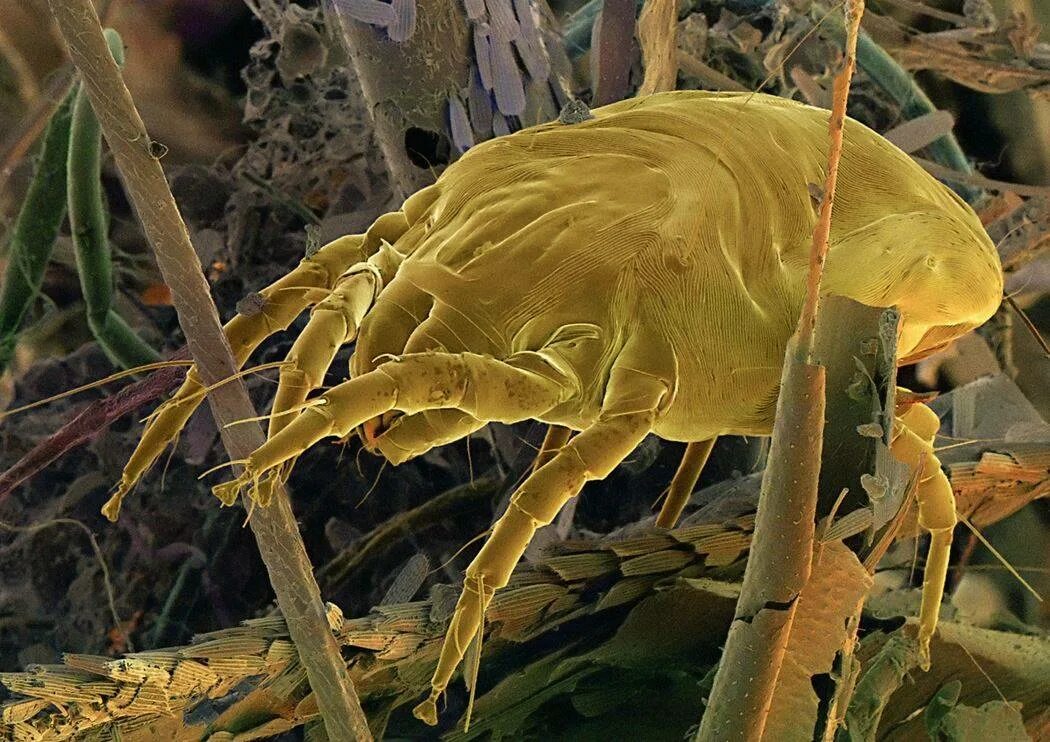 Бактерии клещей. Сапрофиты пылевые клещи. Клещ сапрофит под микроскопом. Сапрофиты комменсалы. Сапрофиты под микроскопом.