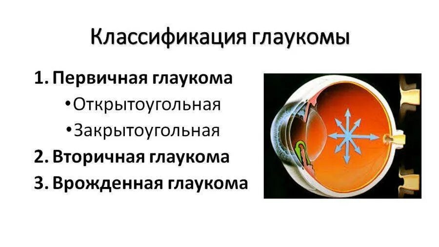 Первичная открытоугольная глаукома этиология. Первичная врожденная глаукома классификация. Первичная закрытоугольная глаукома классификация. Закрытоугольная глаукома профилактика.