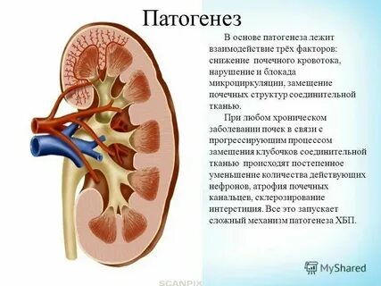 Хим состав почек