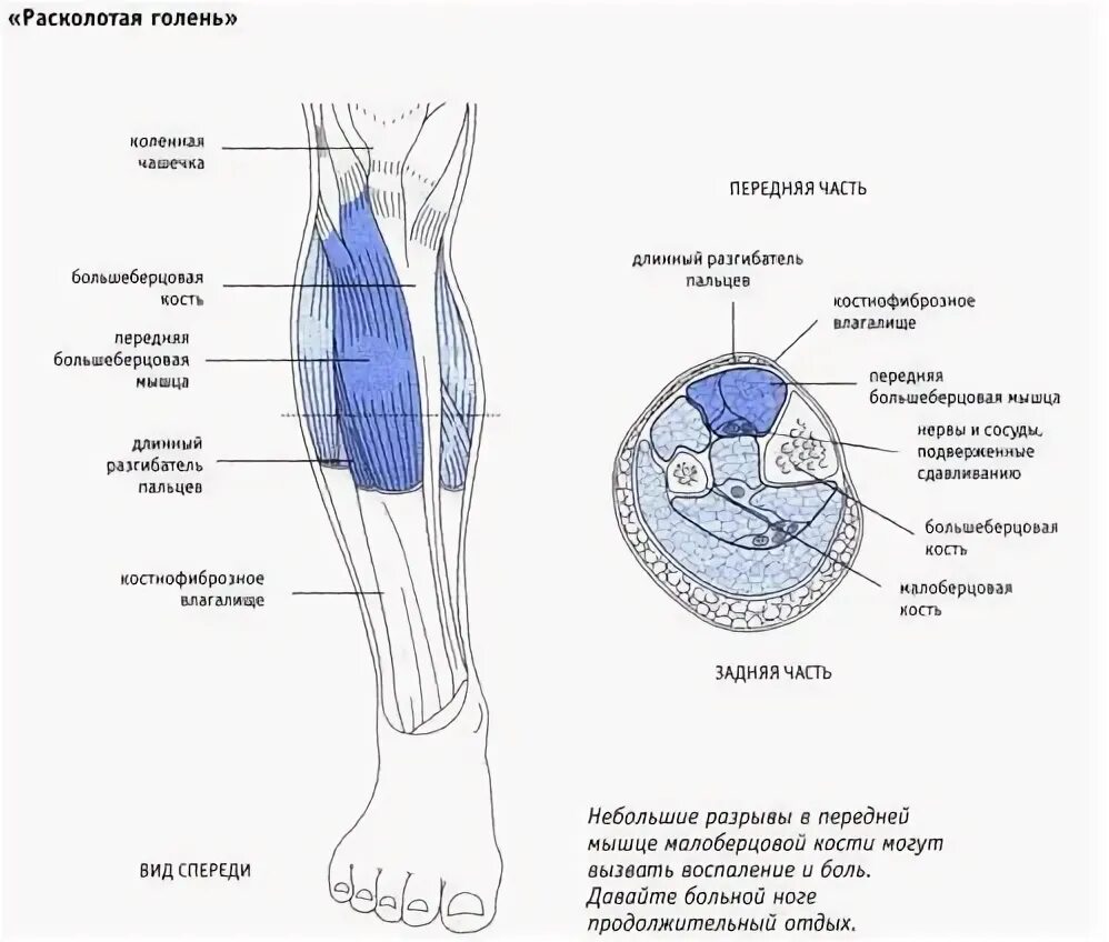 Боль в голени спереди причины