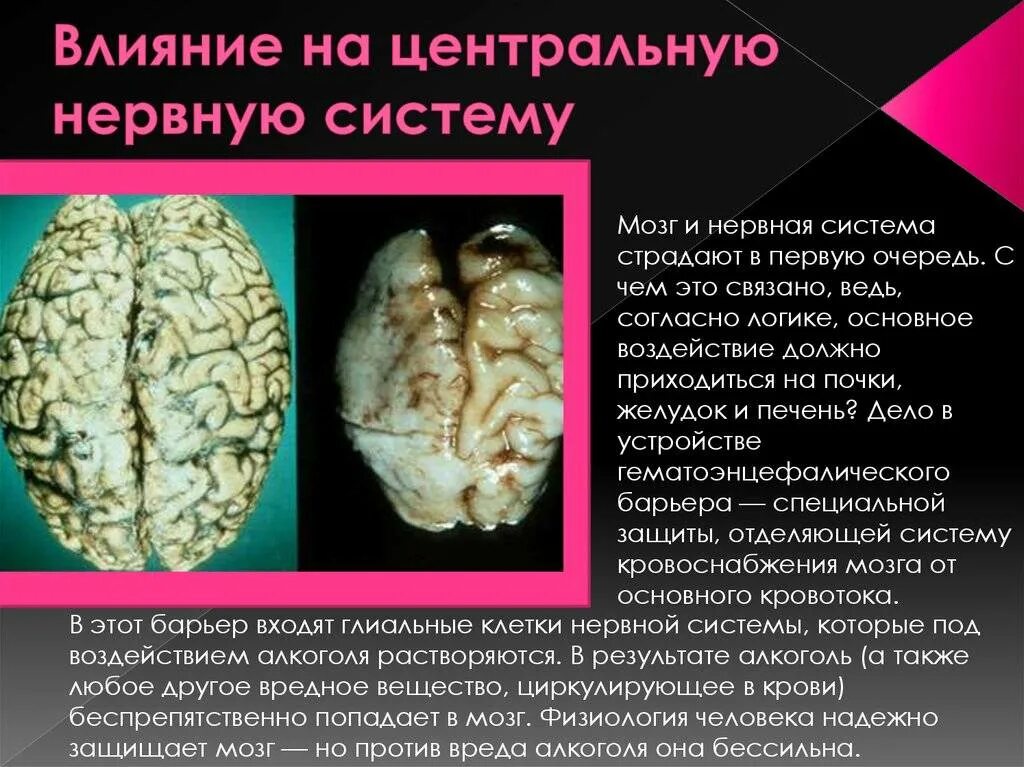 Поражение головного мозга последствия. Влияние этанола на мозг.