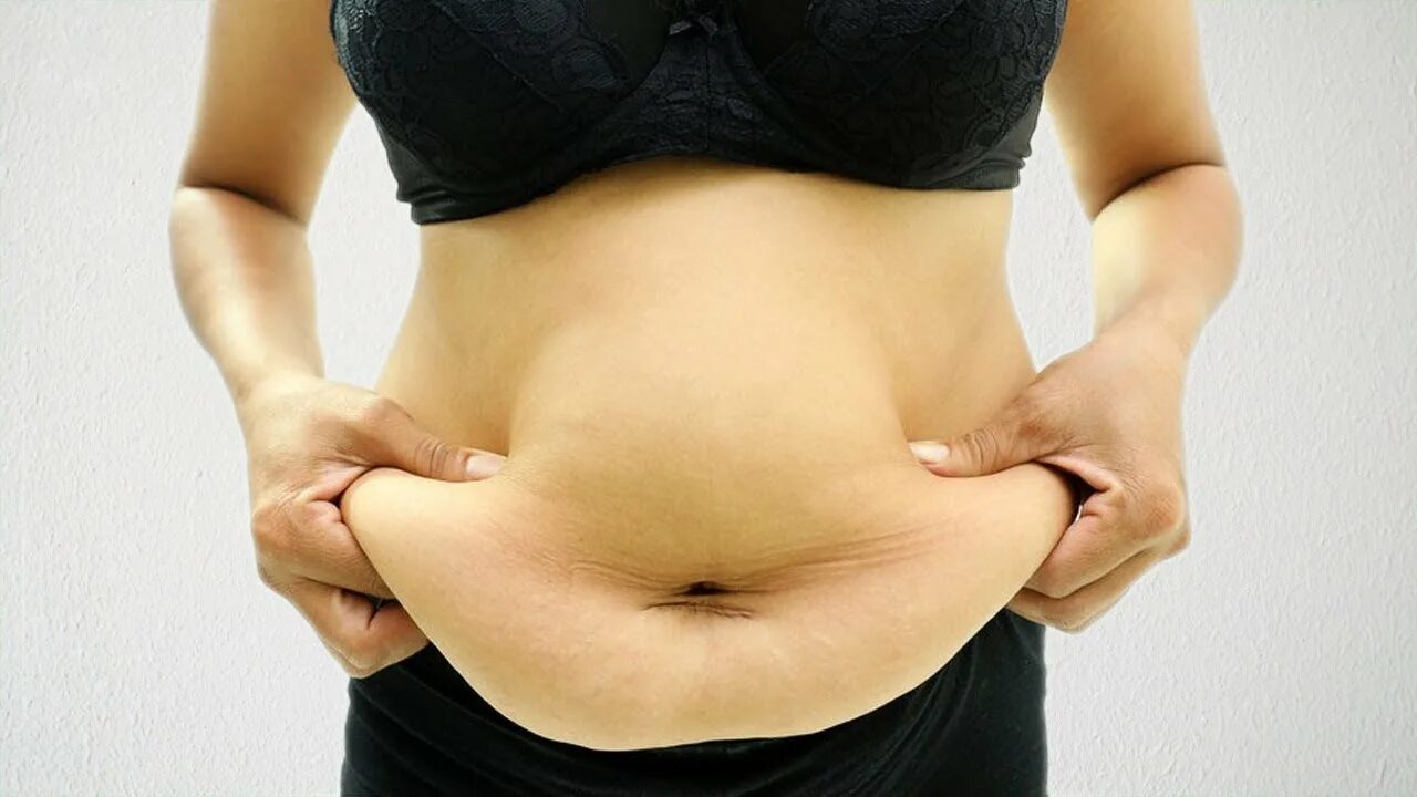 Очень большой живот что делать. Очень большой живот что делать. Жирок на животе женщины. Жир на животе у женщин. Большой живот у женщины жир.