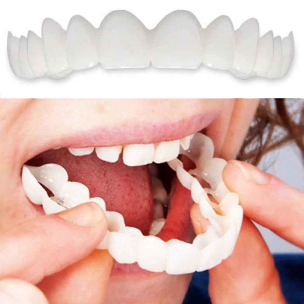 Сделать зубы в китае. Виниры для зубов snapon smile (белый). накладные зубы snap on smile. съемные виниры snap-on smile.