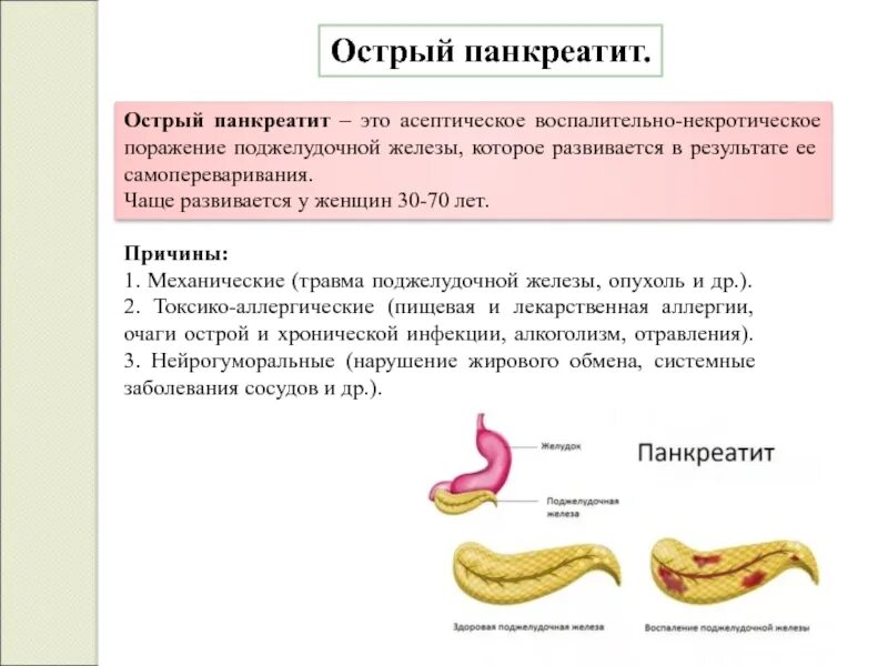 Панкреатит острый панкреатит. Острый панкреатит поджелудочной железы. Острый панкреатит причины возникновения. Панкреатит происхождение