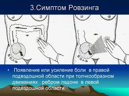 3 симптома