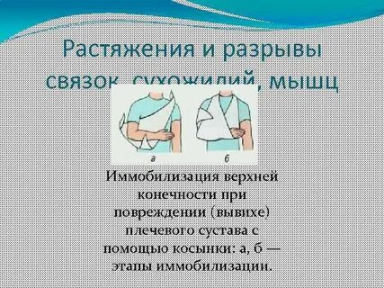 Вывихи верхней конечности
