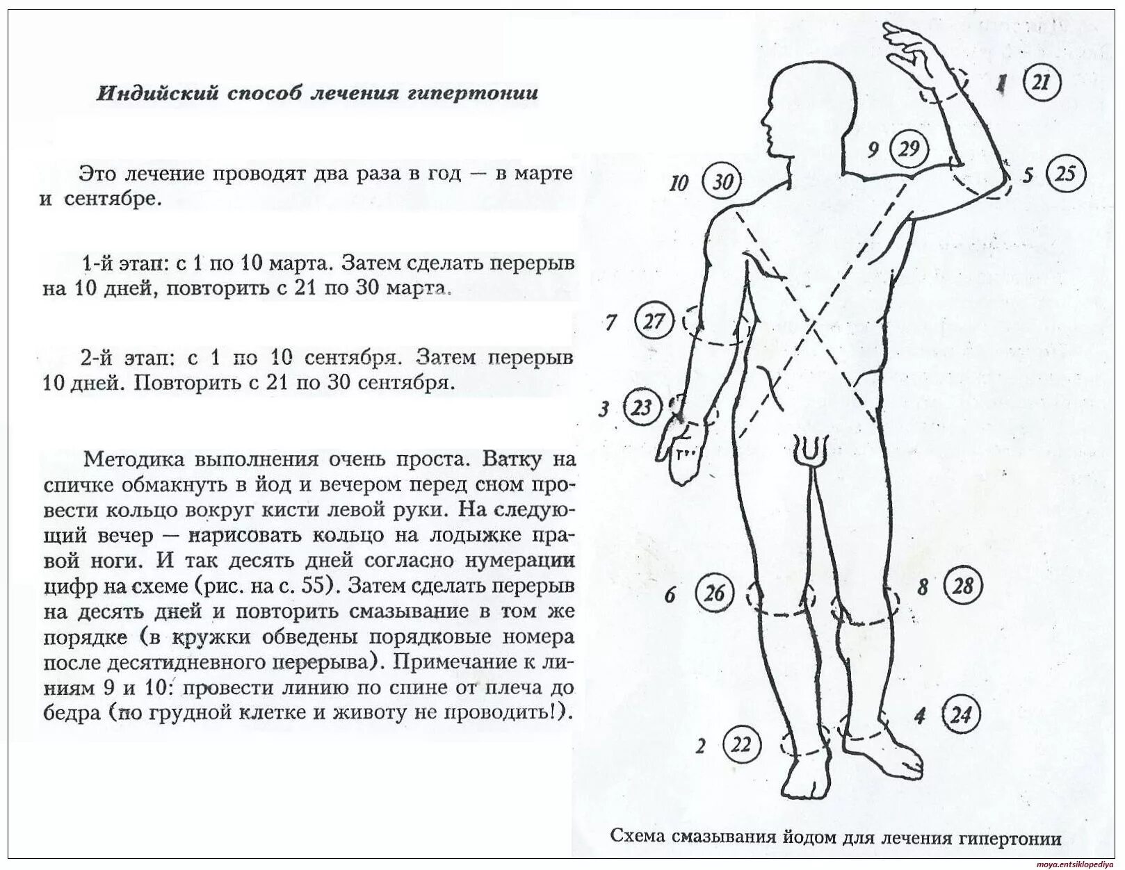 Методы лечения гипертонии. Лечение гипертонии йодом схема. Индийская методика лечения давления йодом. Индийский метод лечения гипертонии йодом. Индийская методика от гипертонии.