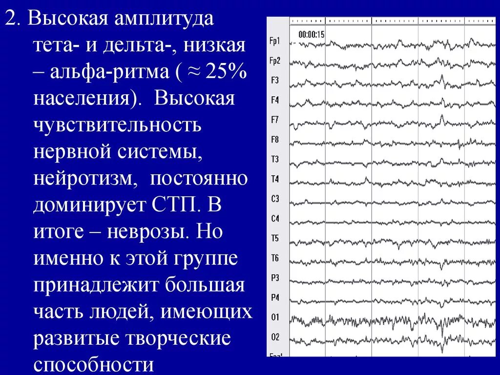 Легкие изменения ээг. ЭЭГ головного мозга ритм Альфа ритм норма. Альфа ритм на ЭЭГ норма. ЭЭГ головного мозга Альфа ритм норма. Амплитуда Альфа и бета ритма на ЭЭГ.