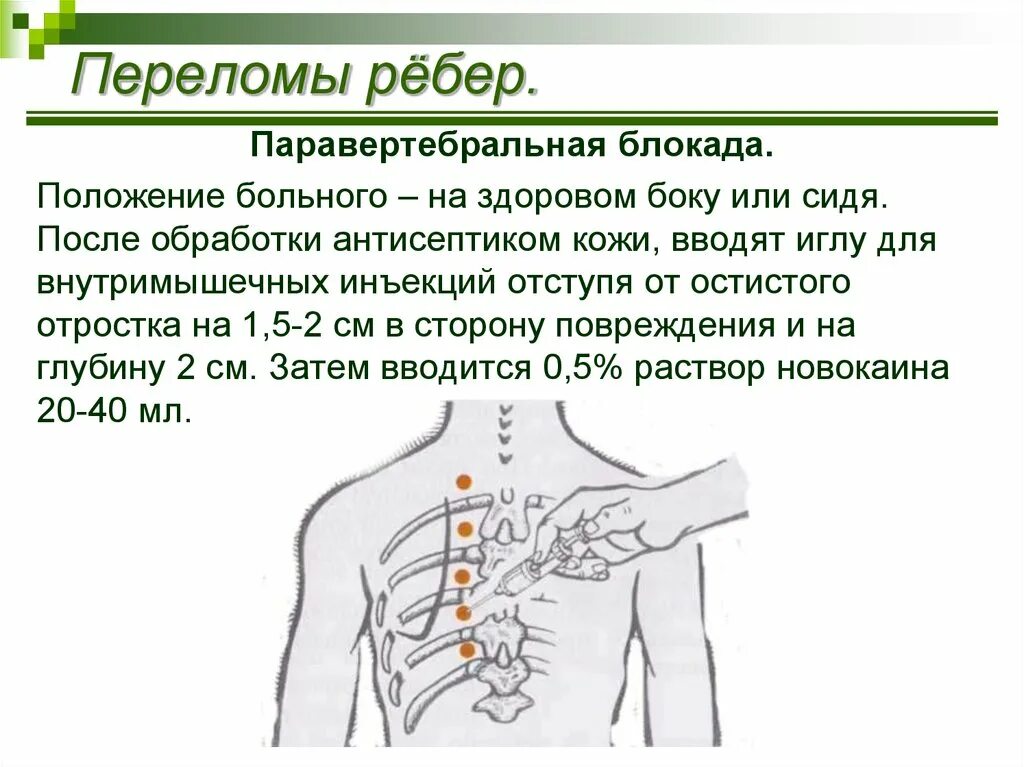 Блокада показания. Паравертебральная блокада грудной отдел техника. Паравертебральная поясничного отдела. Паравертебральная блокада грудного отдела позвоночника техника. Паравертебральная блокада. Показания, техника..