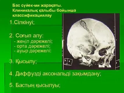 Бас сүйек