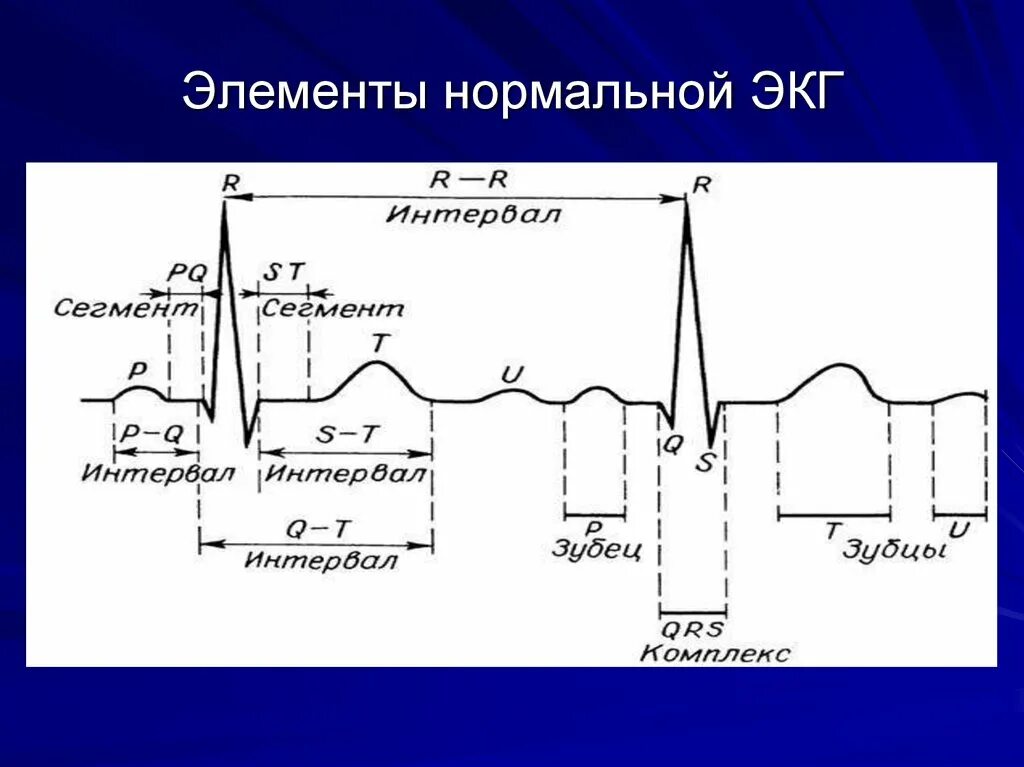 Нормы длительности зубцов и интервалов ЭКГ. Нормальные показатели интервалов ЭКГ. ЭКГ расшифровка зубцов в норме. Нормальная ЭКГ зубцы сегменты интервалы. Экг со скольки