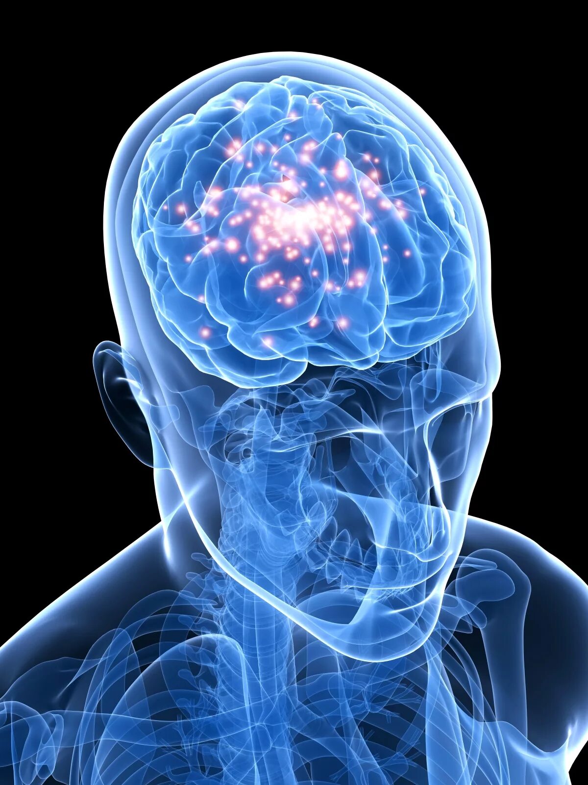 Brain and some. Инфекция головного мозга. Мозг эпилептика.