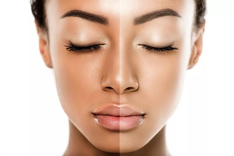 Face whitening result. Сухой тип кожи. Тусклая кожа лица. Отбеливание кожи лица. Brighten skin tone.