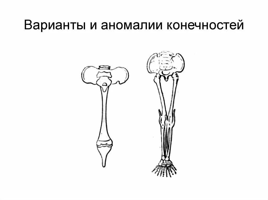 Аномалии развития верхних конечностей. Пороки развития конечностей. Аномалии развития скелета конечностей. Аномалии скелета верхних конечностей.