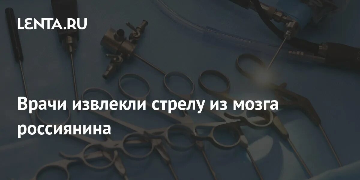 Как вытащить стрелу. Аполлон вынимающий стрелу из колчана щедрин.