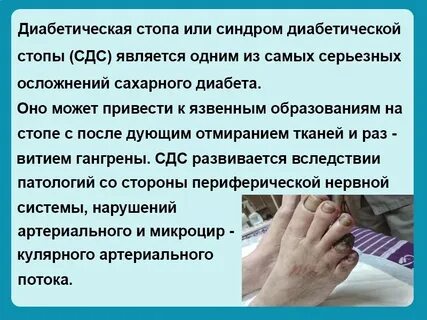 Сахарный диабет заболевание ног