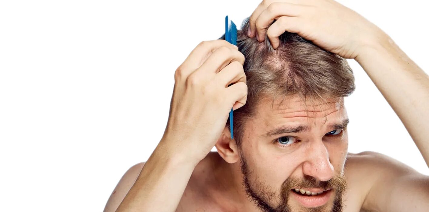 Проблемной мужские волоса. Секущие волосы у мужчин. Мужчина расчесывает волосы. Раннее облысение у мужчин. Волосы на голову мужские