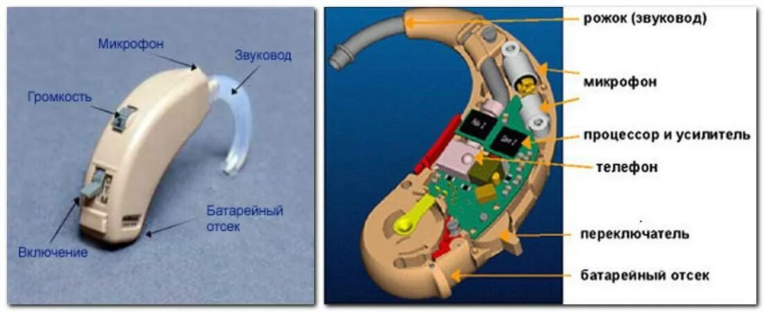 Где подобрать слуховой аппарат. Строение слухового аппарата заушного. Слуховой аппарат dp7. Слуховой аппарат u 2m 4 комплектующие. Слуховой аппарат XTM M p6.