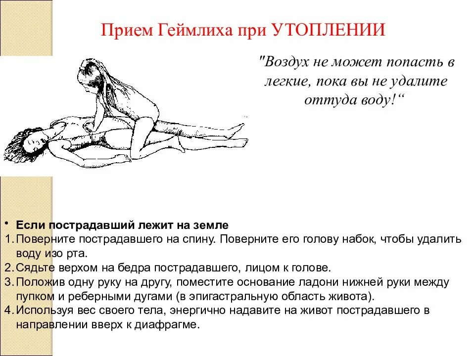 Метод геймлиха это. Прием геймлиха. приём геймлиха алгоритм. приём геймлиха техника. приём геймлиха у детей.