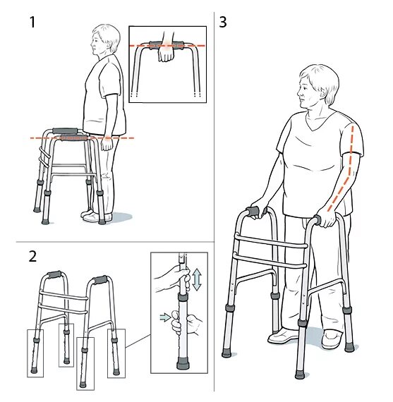 Какие костыли после эндопротезирования. Для инвалидов приспособления для ходьбы ходунки для пожилых. Ходунки для инвалидов с ампутированной ногой. Ходунки алгоритм пользования. Приспособьен я дя хотдьбы.